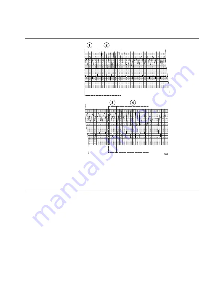 Medtronic PROTECTA XT DR D314DRG Clinician Manual Download Page 371