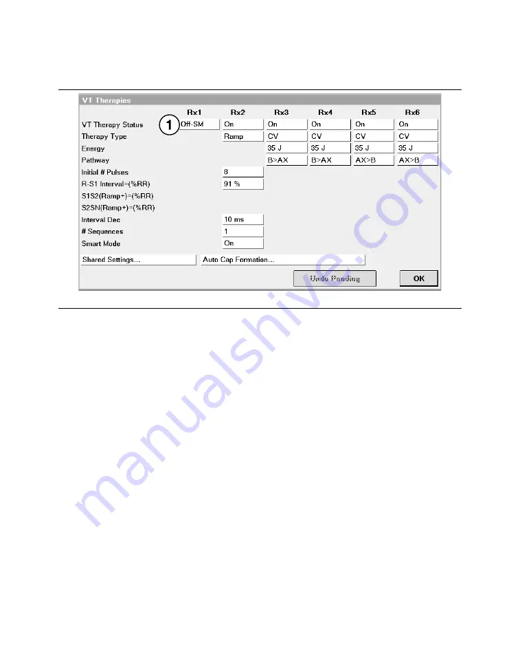 Medtronic PROTECTA XT DR D314DRG Скачать руководство пользователя страница 380