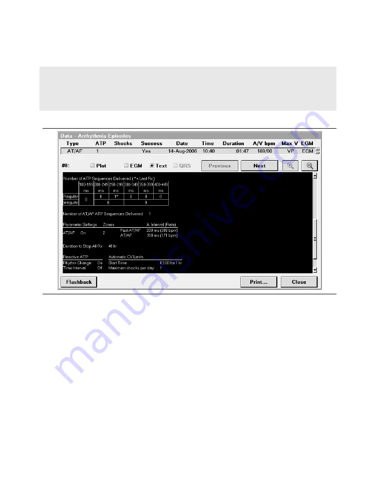 Medtronic PROTECTA XT DR D314DRG Clinician Manual Download Page 395