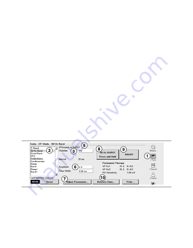 Medtronic PROTECTA XT DR D314DRG Clinician Manual Download Page 439