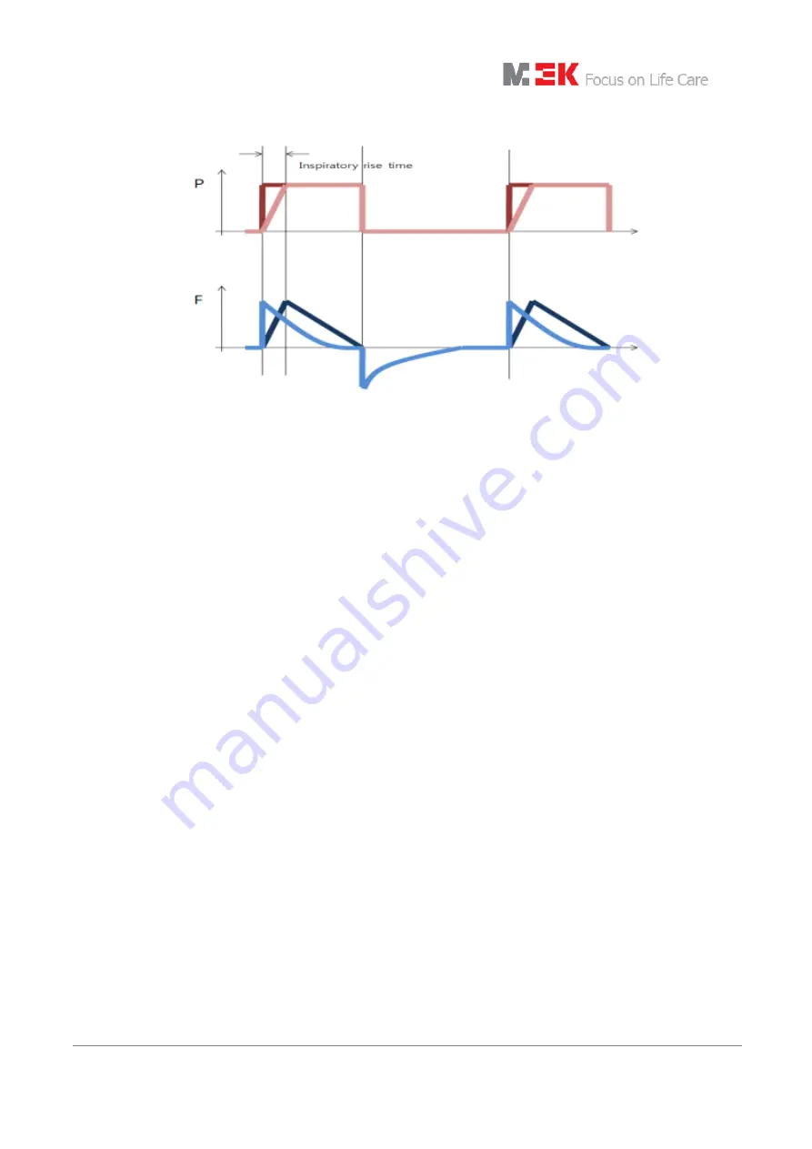 MEK MTV1000 User Manual Download Page 63