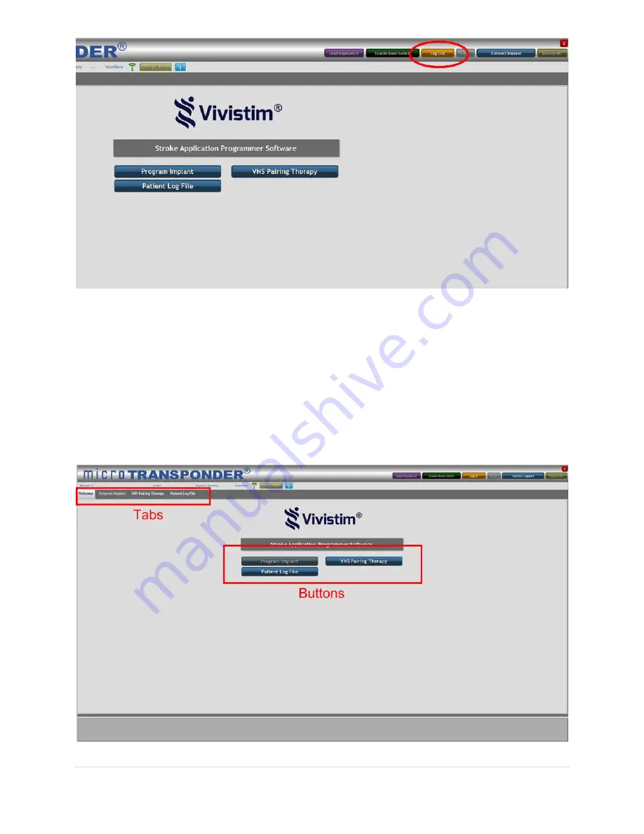 MicroTransponder 2100 Manual Download Page 14