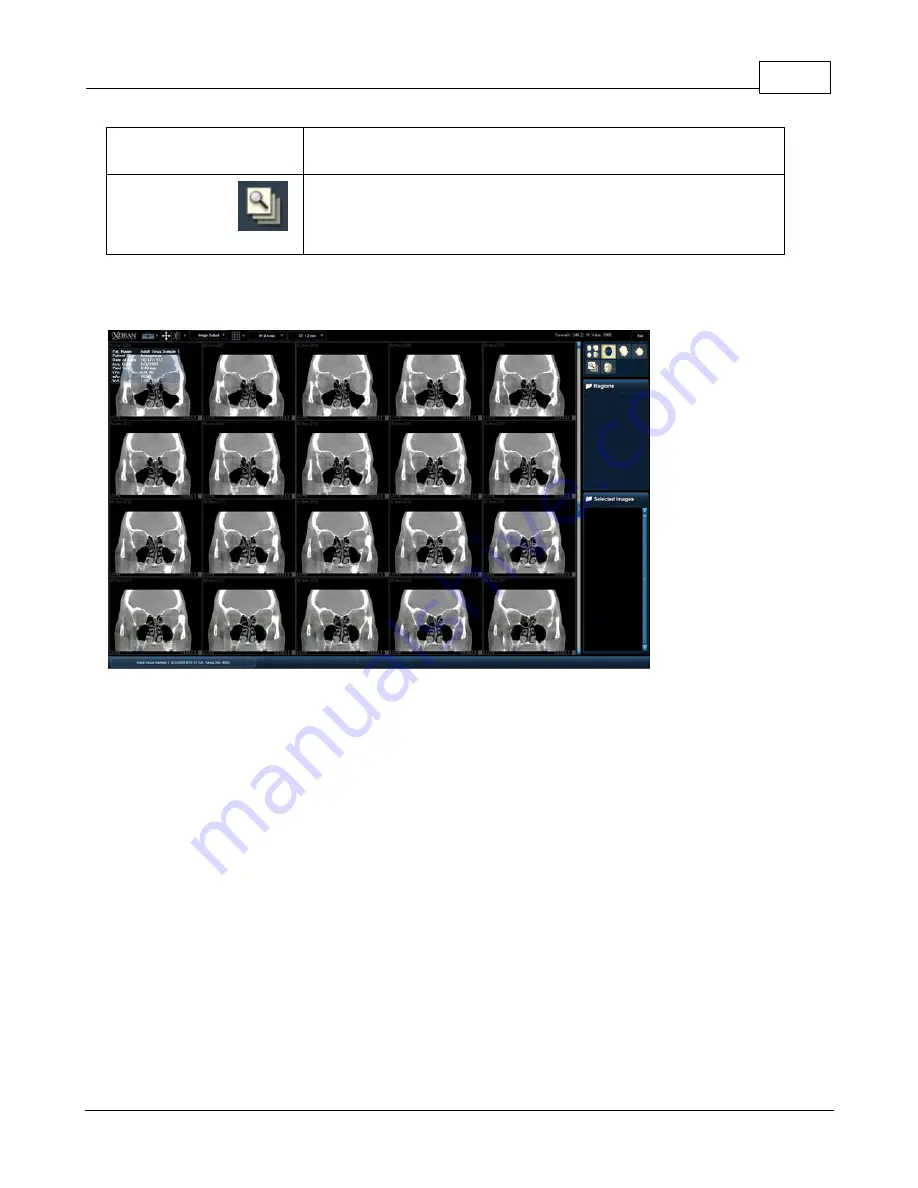 Minicat xoran User Manual Download Page 55