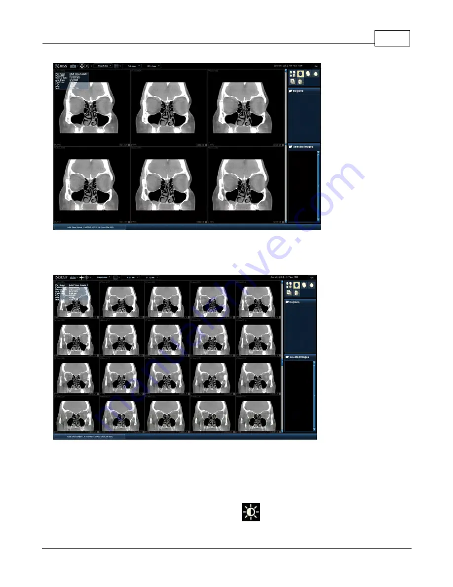 Minicat xoran User Manual Download Page 62