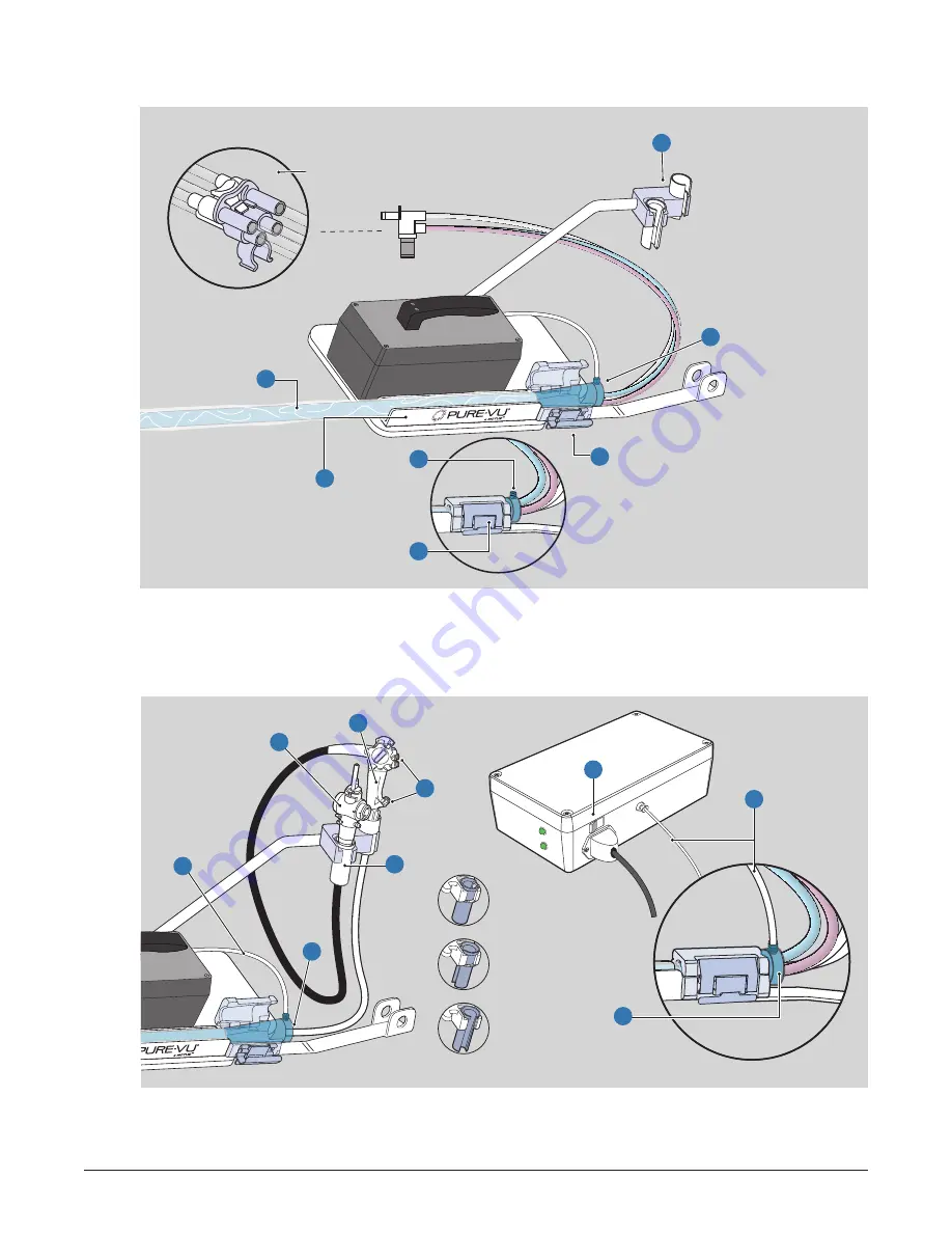 Motus GI Pure-Vu System Instructions For Use Manual Download Page 11