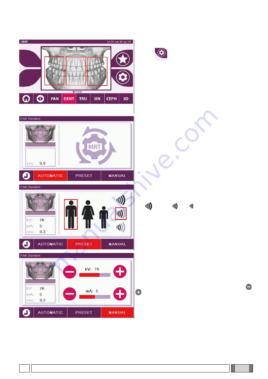 Myray hyperion X9 Operator'S Manual Download Page 709