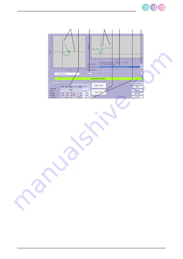 NDD easyone pro Operator'S Manual Download Page 49