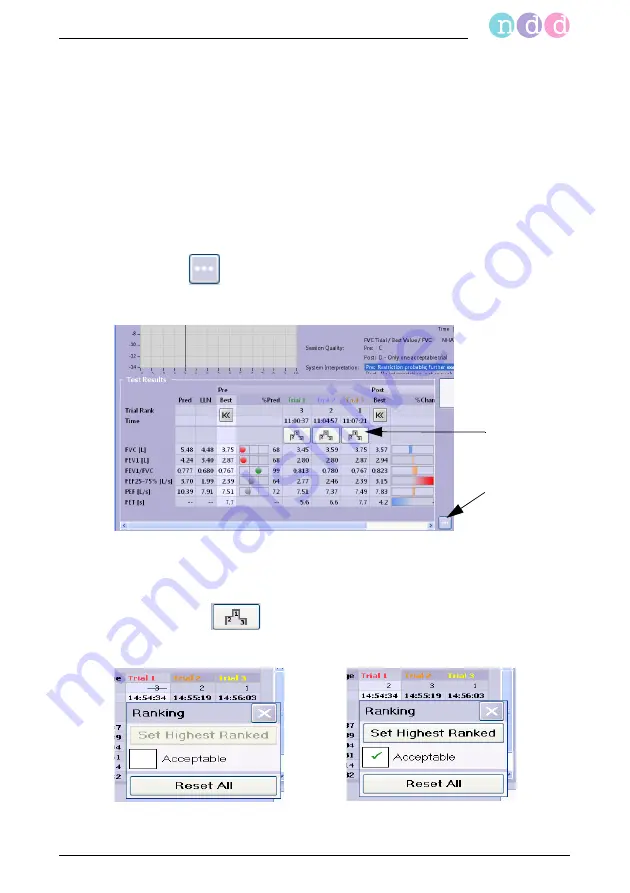 NDD easyone pro Operator'S Manual Download Page 97