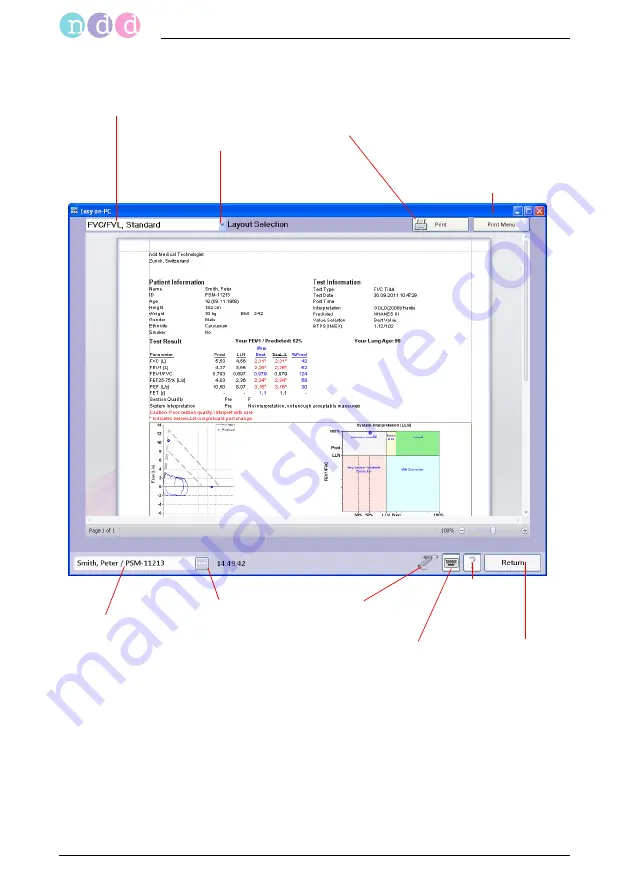 NDD easyone pro Скачать руководство пользователя страница 174