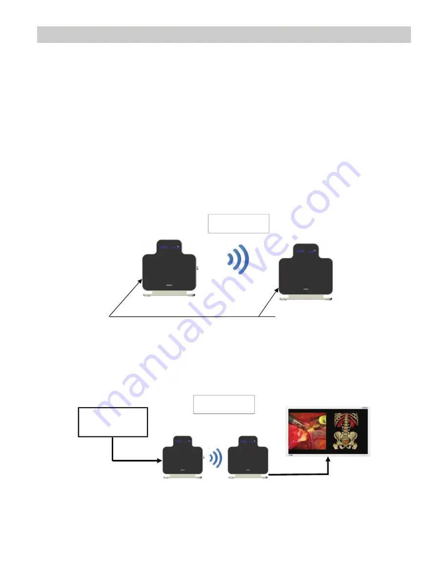 Nds surgical imaging Zero Wire Duo User Manual Download Page 15