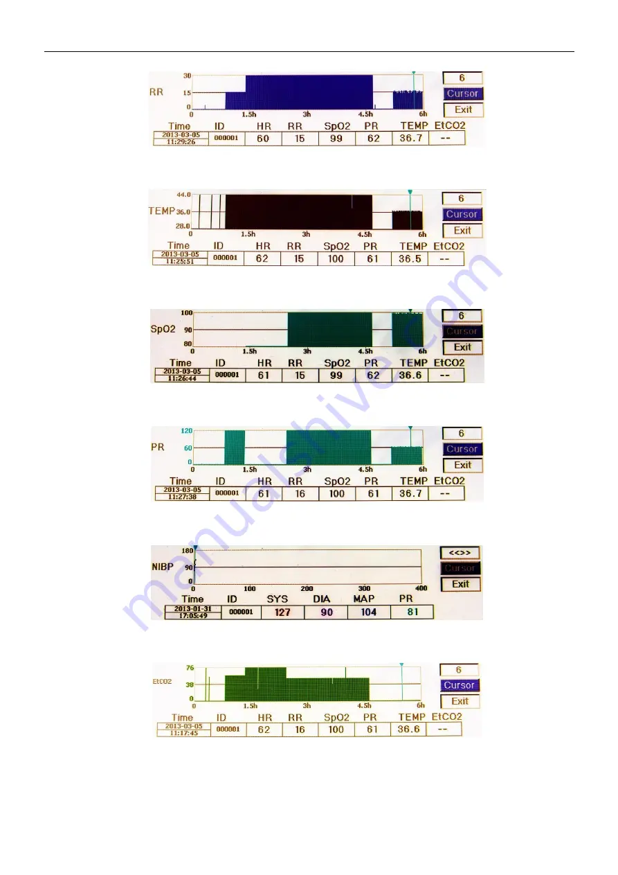 North-Vision Tech Deluxe-100 User Manual Download Page 32