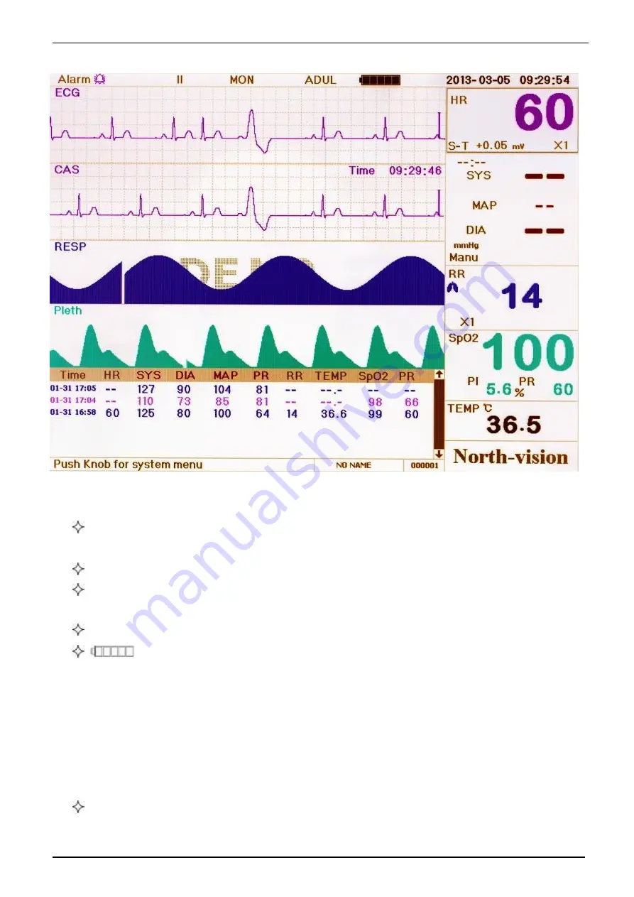 North-Vision Tech Elegant-1100 User Manual Download Page 23