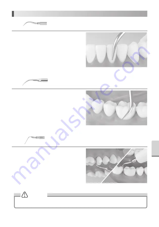 NSK Varios 970 Operation Manual Download Page 152