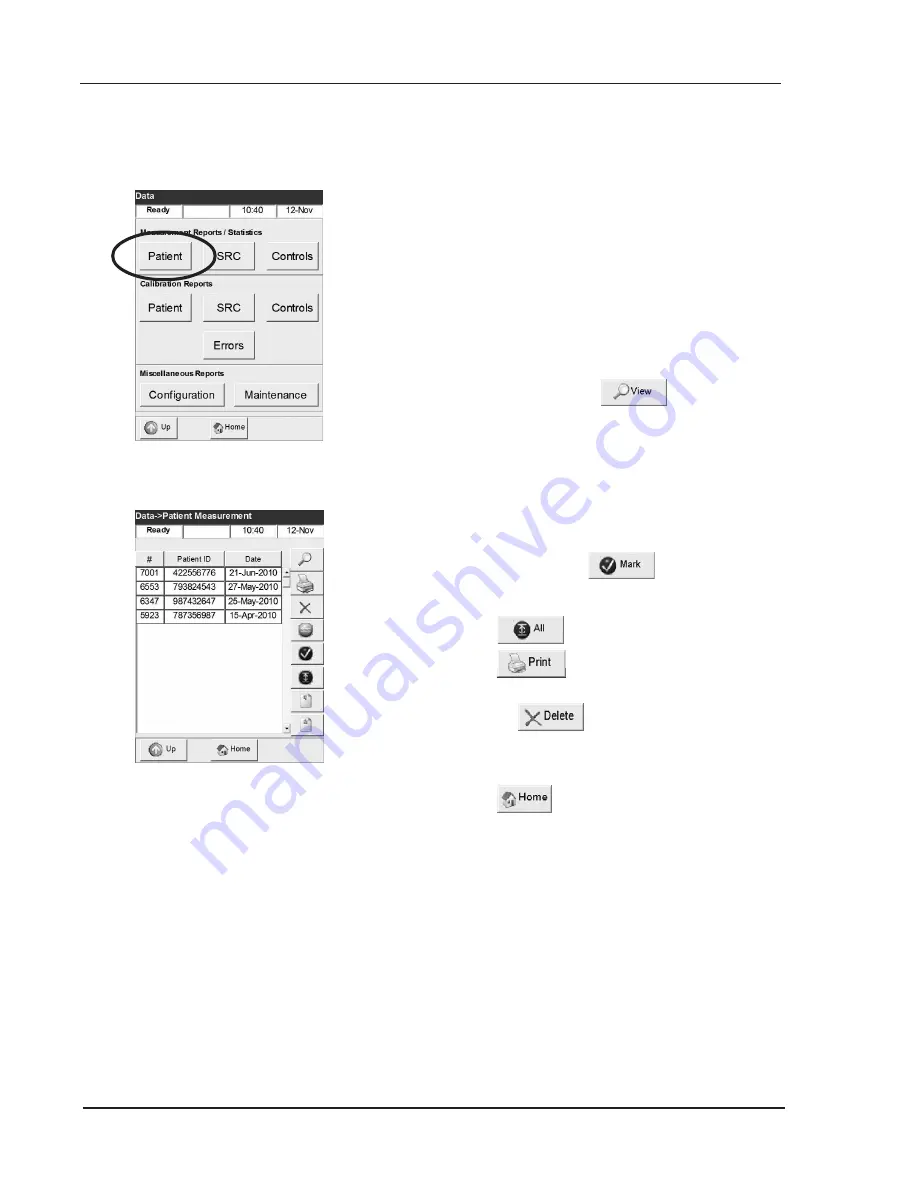 OPTIMedical OPTI CCA-TS Operator'S Manual Download Page 103