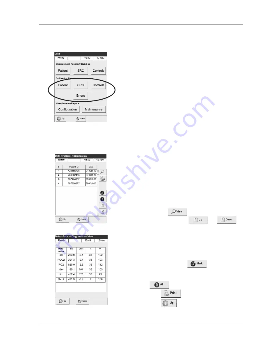 OPTIMedical OPTI CCA-TS Operator'S Manual Download Page 147