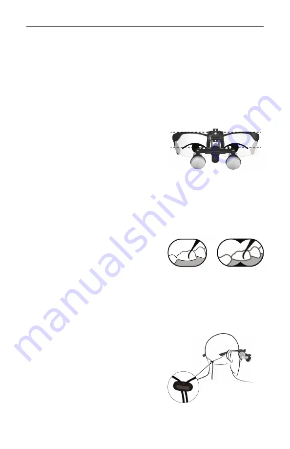 Orascoptic UNIVERSAL FLIP-UP LOUPE Instructions For Use Manual Download Page 6