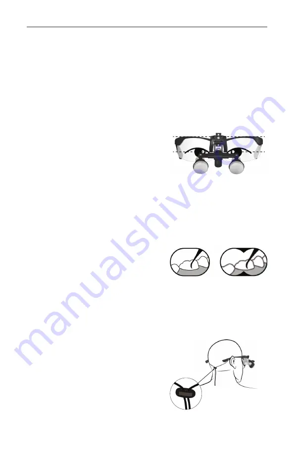 Orascoptic UNIVERSAL FLIP-UP LOUPE Instructions For Use Manual Download Page 62