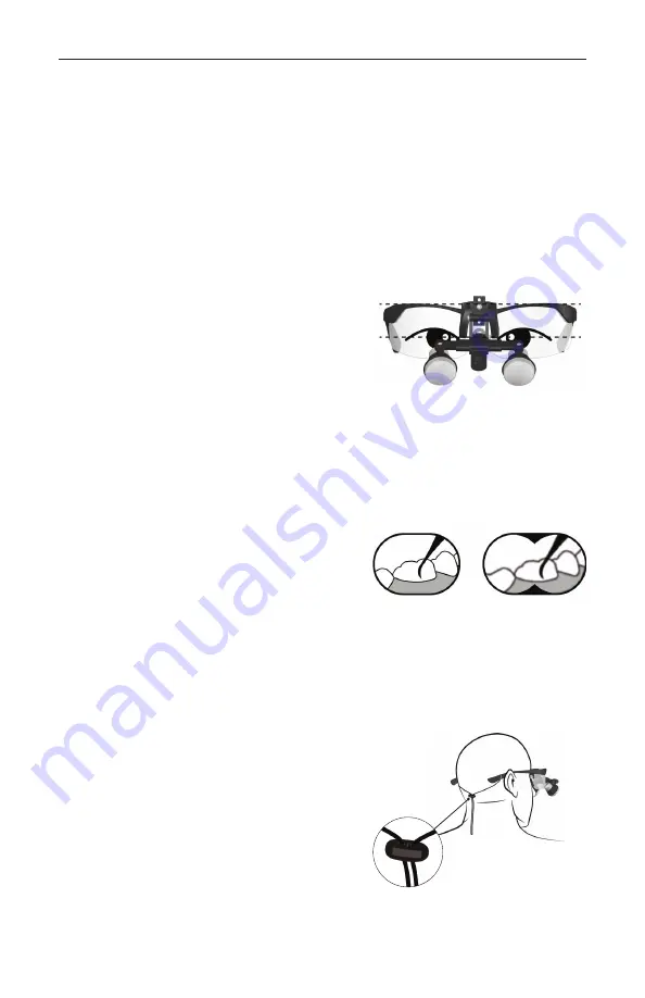 Orascoptic UNIVERSAL FLIP-UP LOUPE Instructions For Use Manual Download Page 102