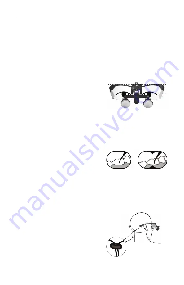 Orascoptic UNIVERSAL FLIP-UP LOUPE Instructions For Use Manual Download Page 190