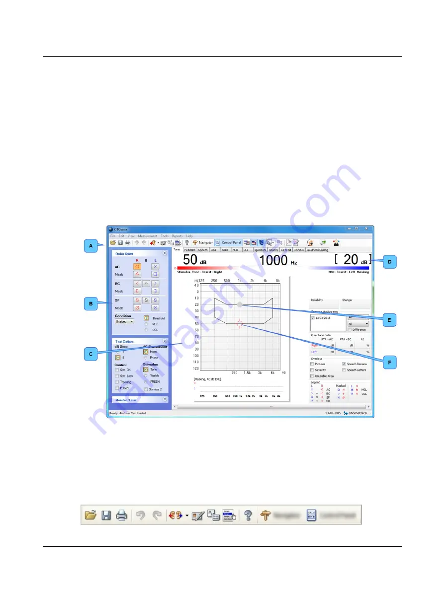 otometrics AURICAL Aud Reference Manual Download Page 13