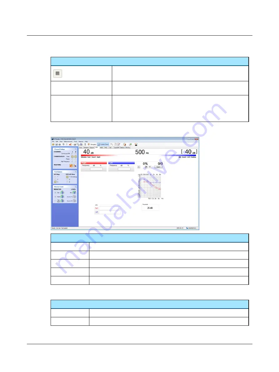 otometrics AURICAL Aud Reference Manual Download Page 59