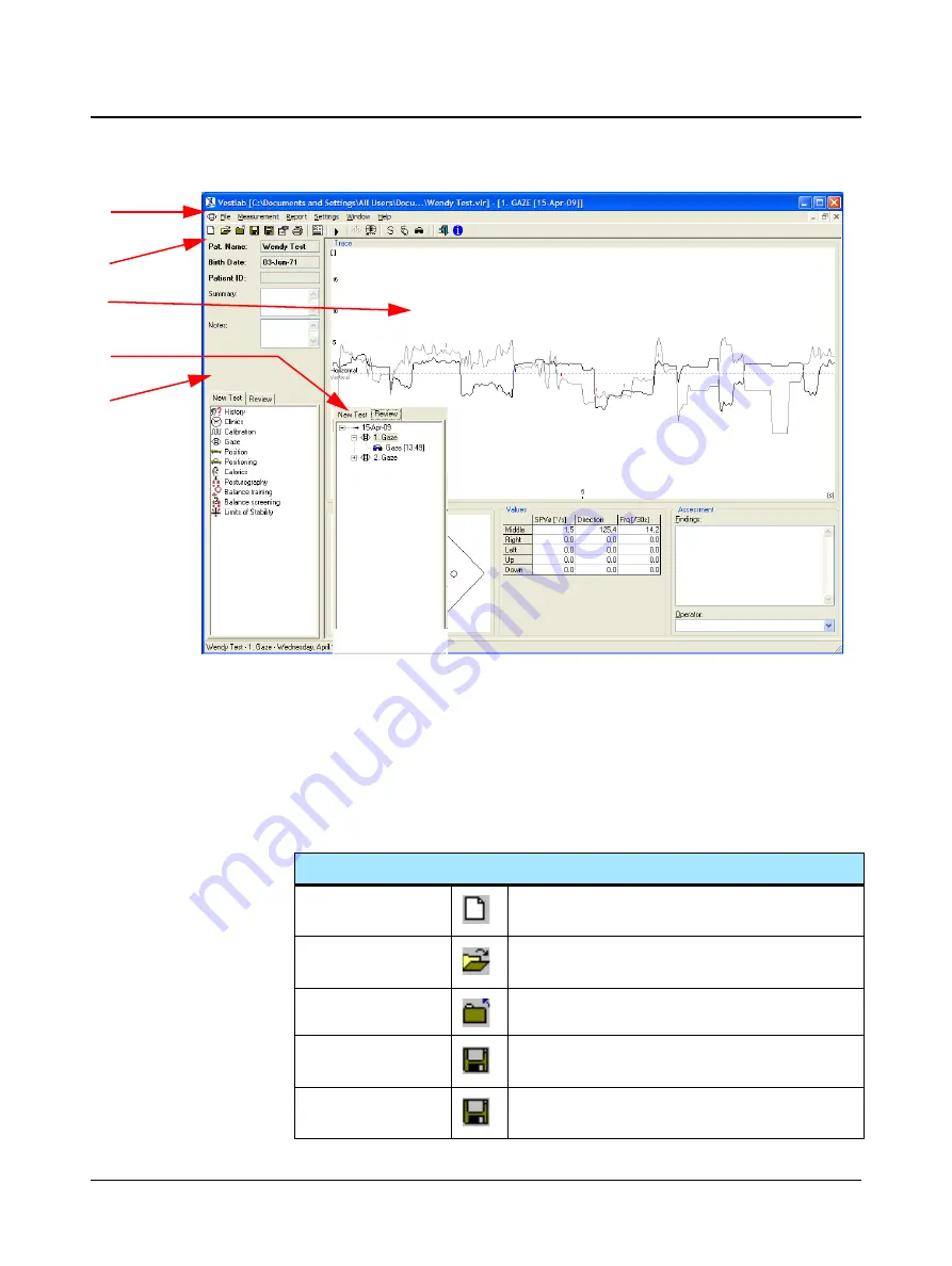 otometrics Hortmann Vestlab 100 User Manual Download Page 18