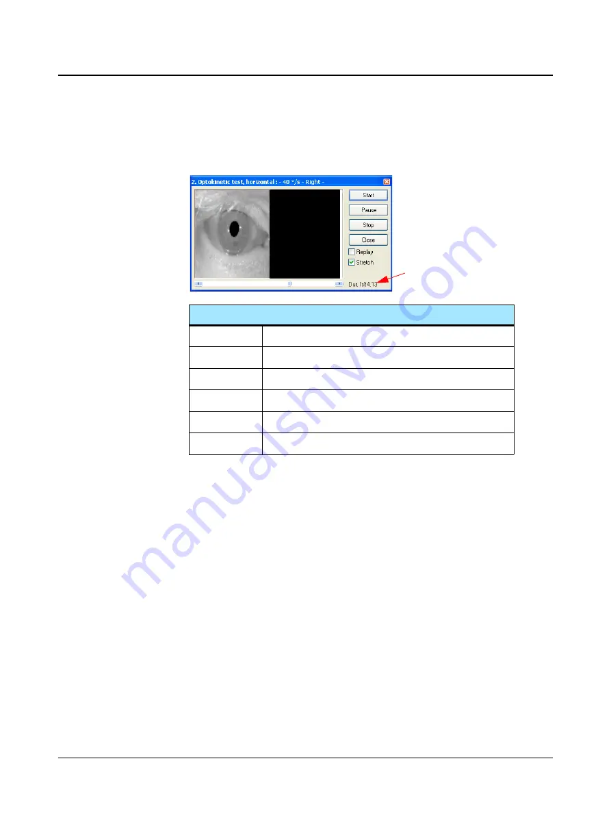 otometrics Hortmann Vestlab 100 User Manual Download Page 42