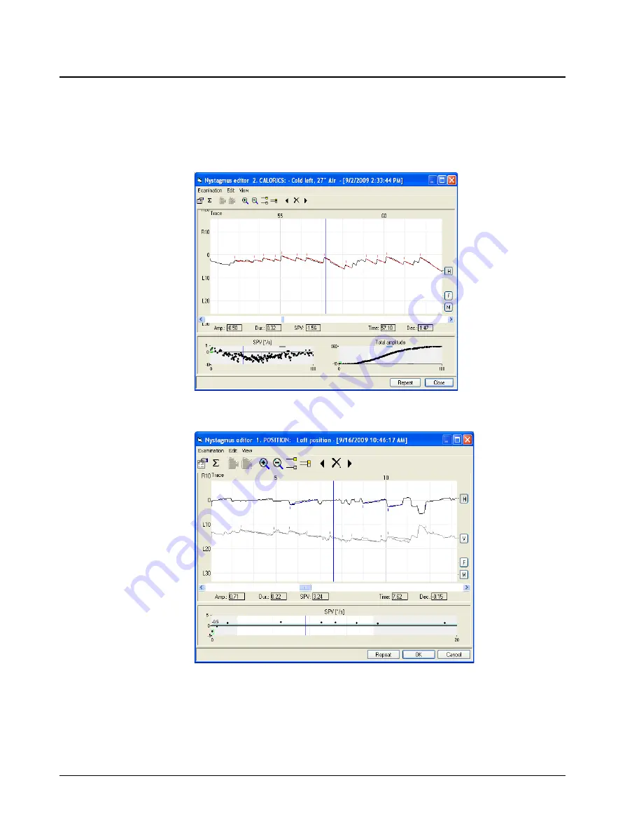 otometrics Hortmann Vestlab 100 User Manual Download Page 43