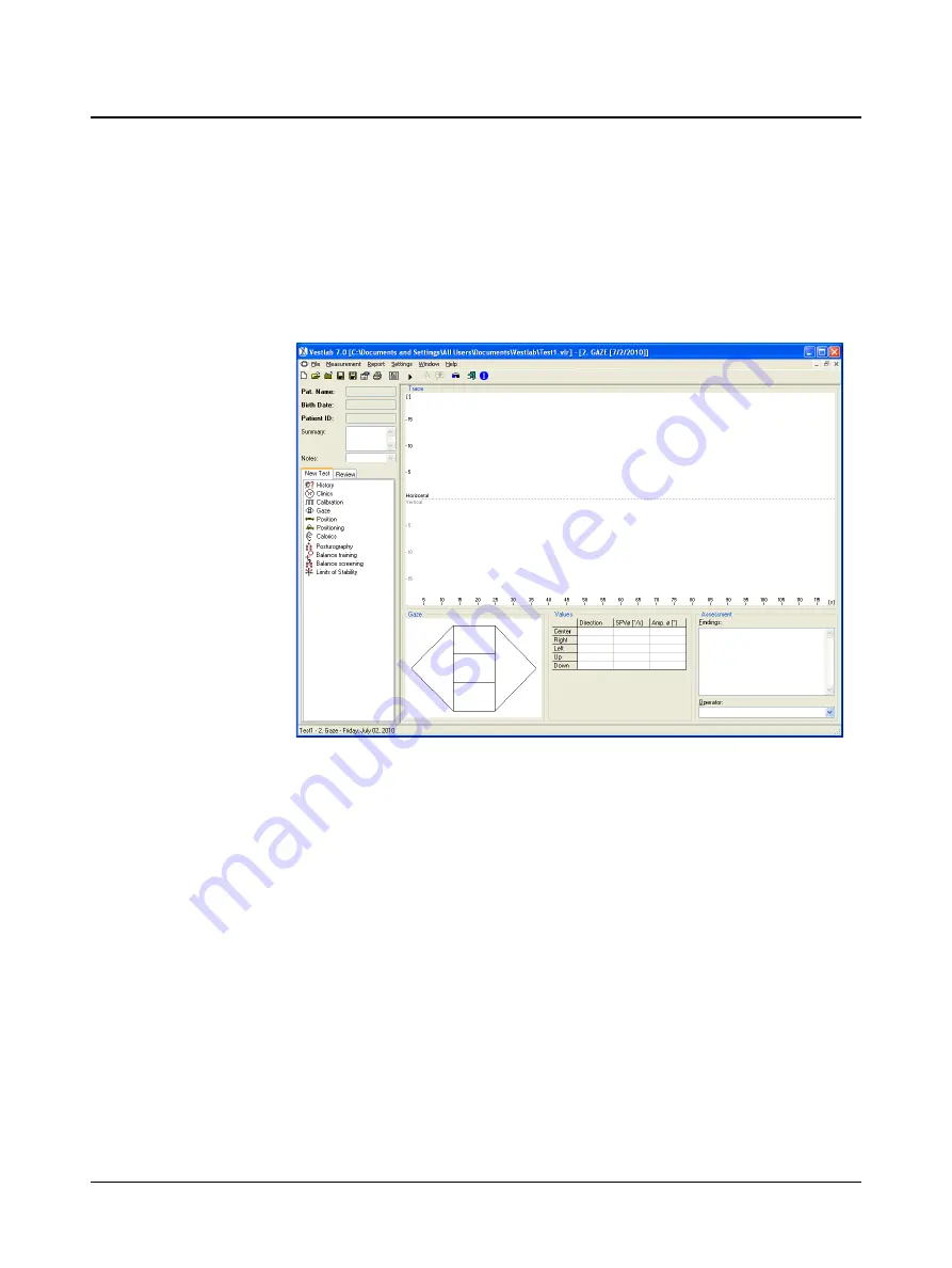 otometrics Hortmann Vestlab 100 User Manual Download Page 56