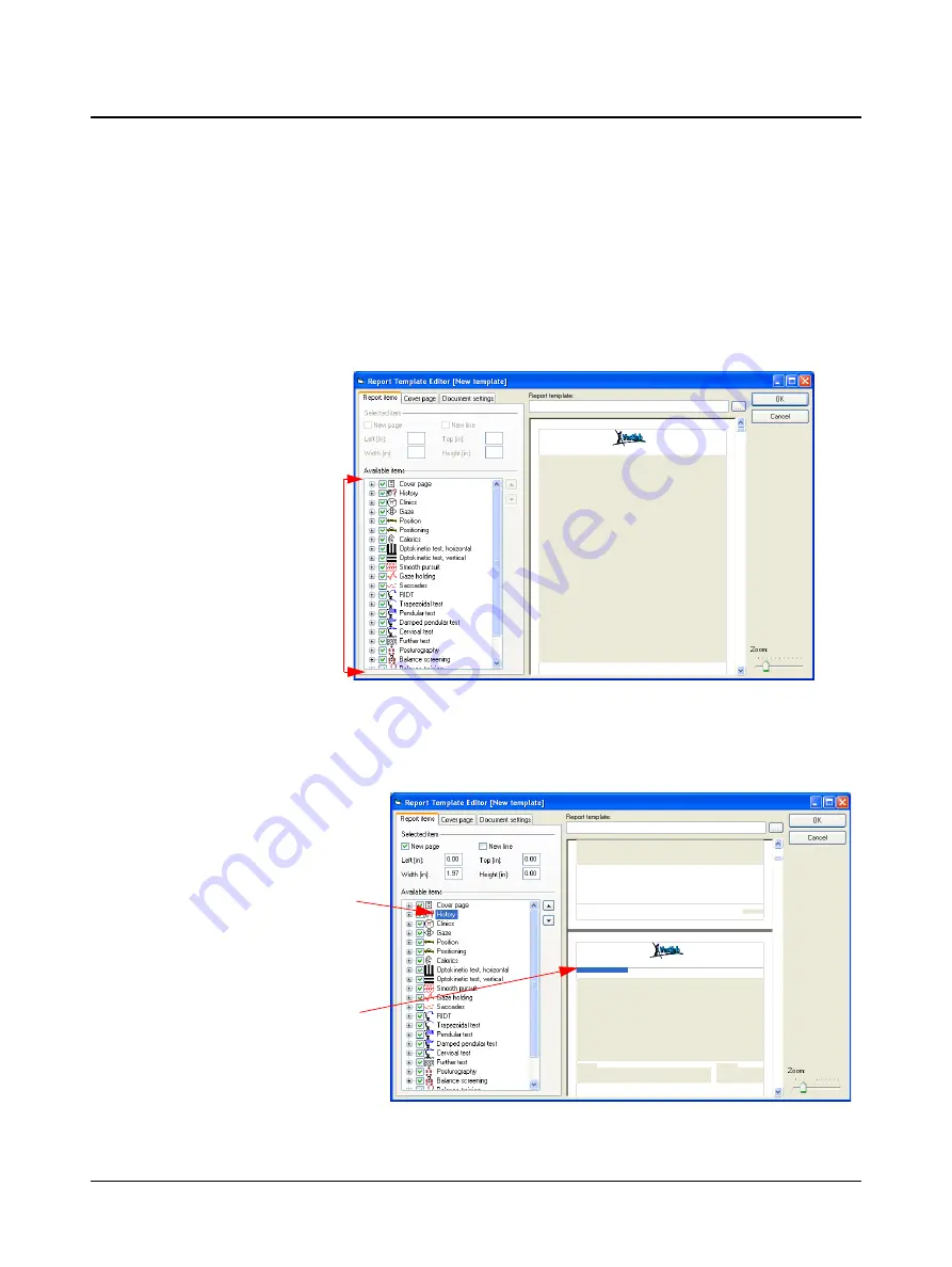 otometrics Hortmann Vestlab 100 User Manual Download Page 84