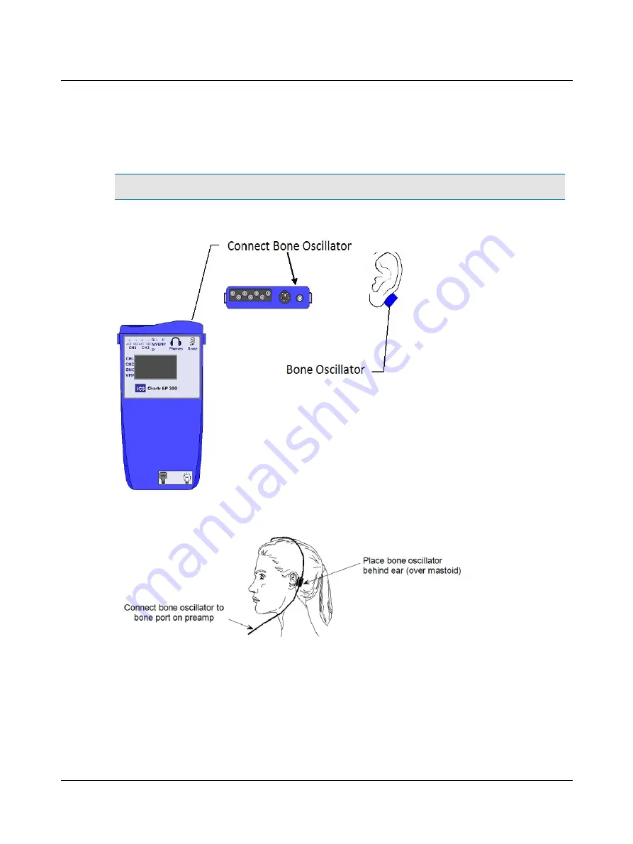 otometrics ICS Chartr EP 200 Скачать руководство пользователя страница 30