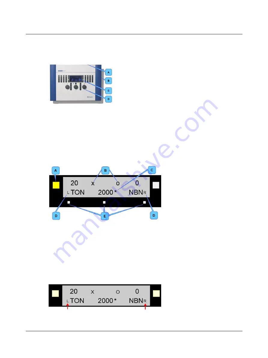 otometrics madsen itera ii Reference Manual Download Page 13