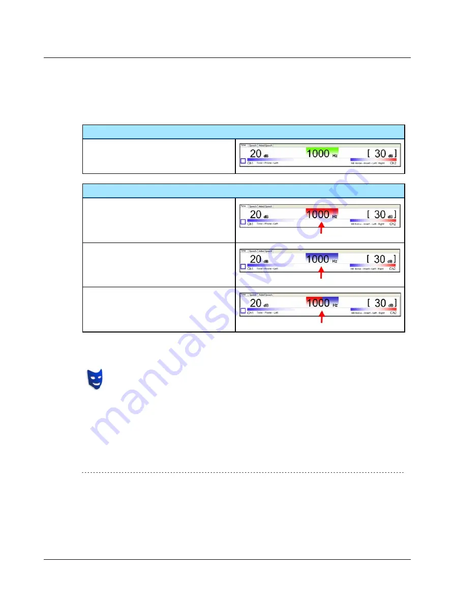 otometrics madsen itera ii Reference Manual Download Page 33