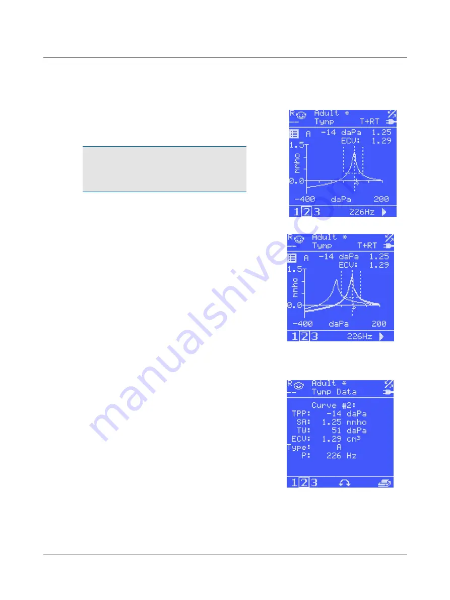 otometrics MADSEN OTOflex 100 Reference Manual Download Page 69