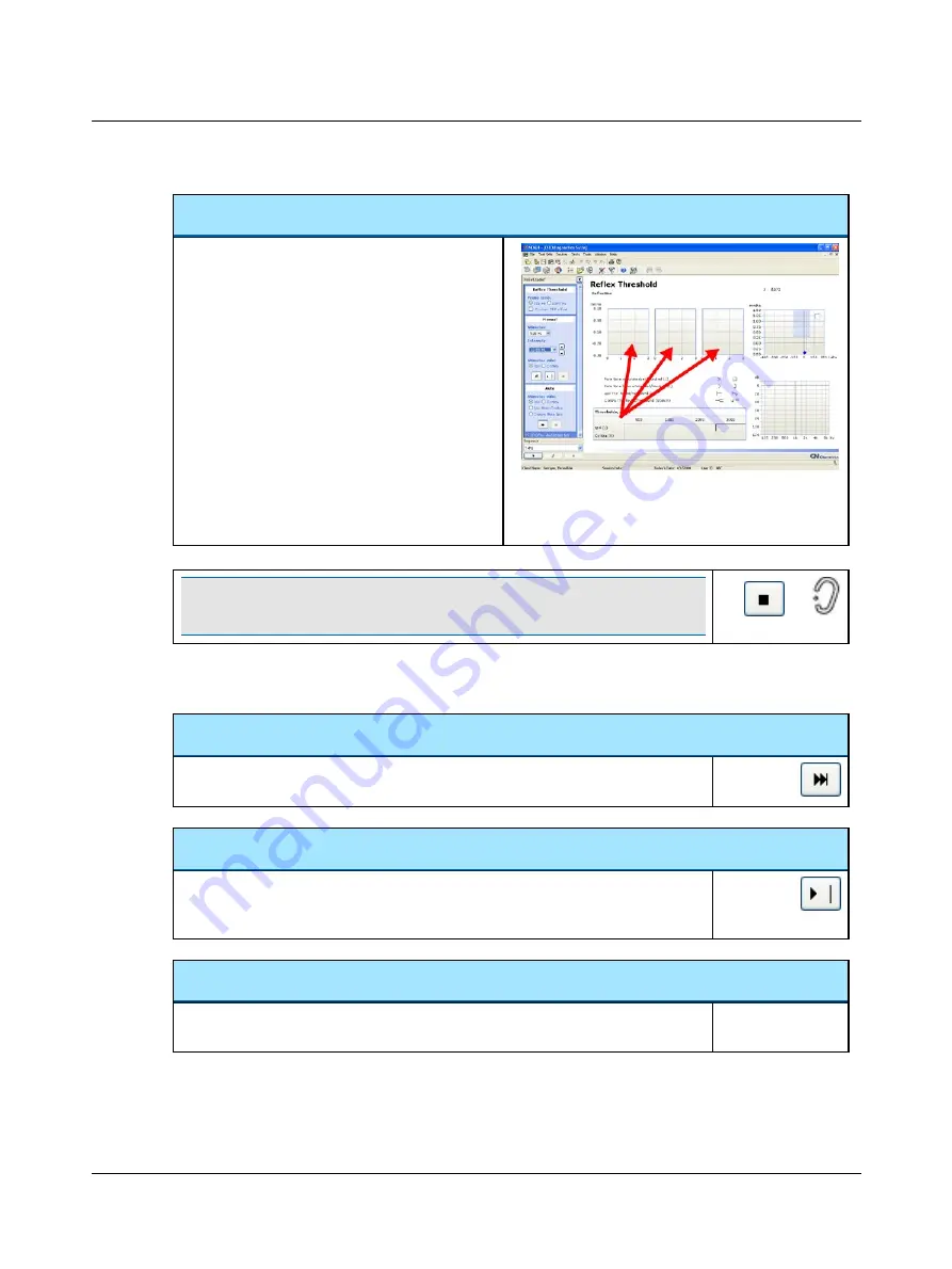 otometrics MADSEN OTOflex 100 Reference Manual Download Page 103