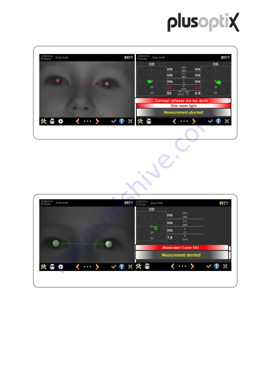 PLUSOPTIX A12C User Manual Download Page 59