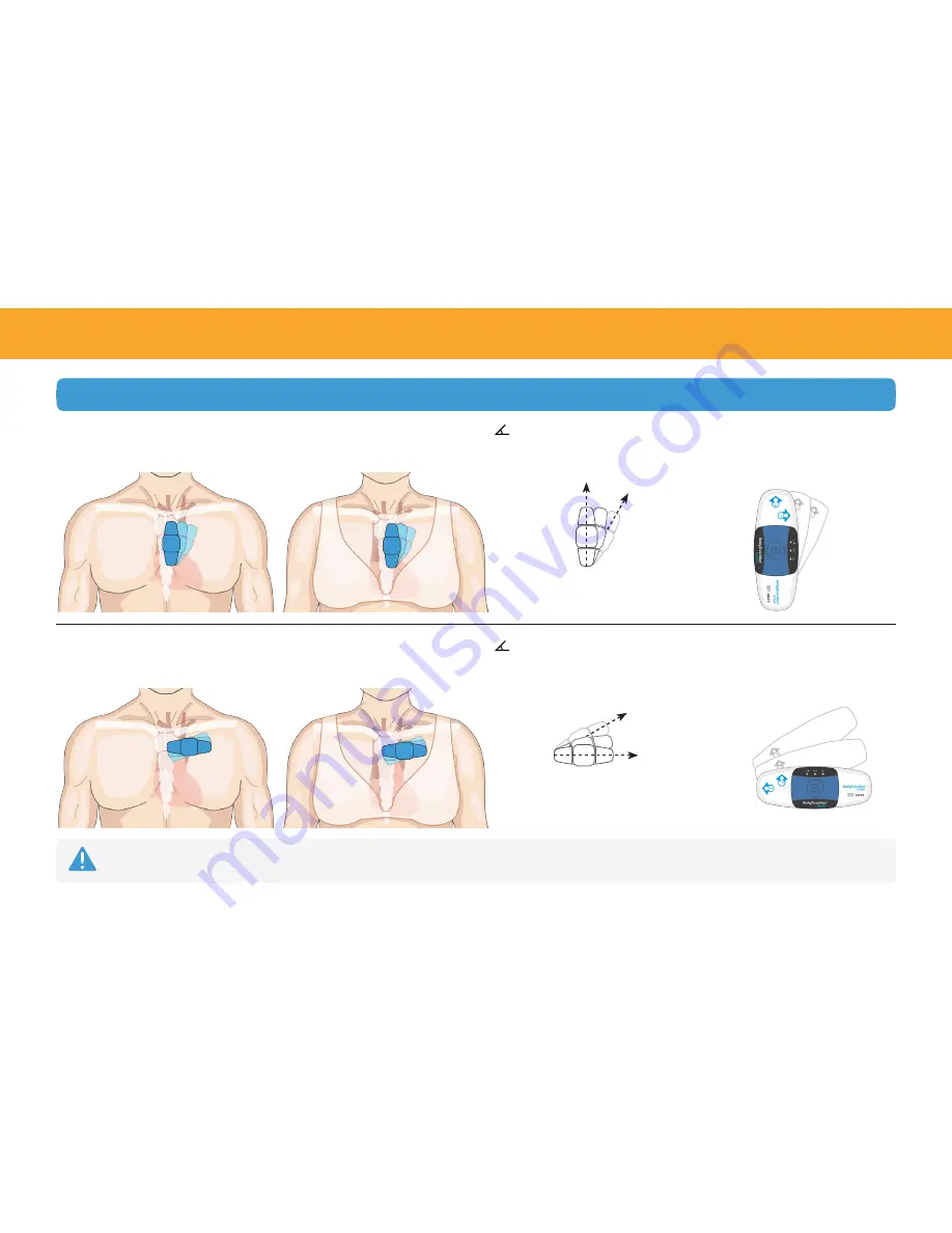 Preventice Solutions BodyGuardian Heart Скачать руководство пользователя страница 9