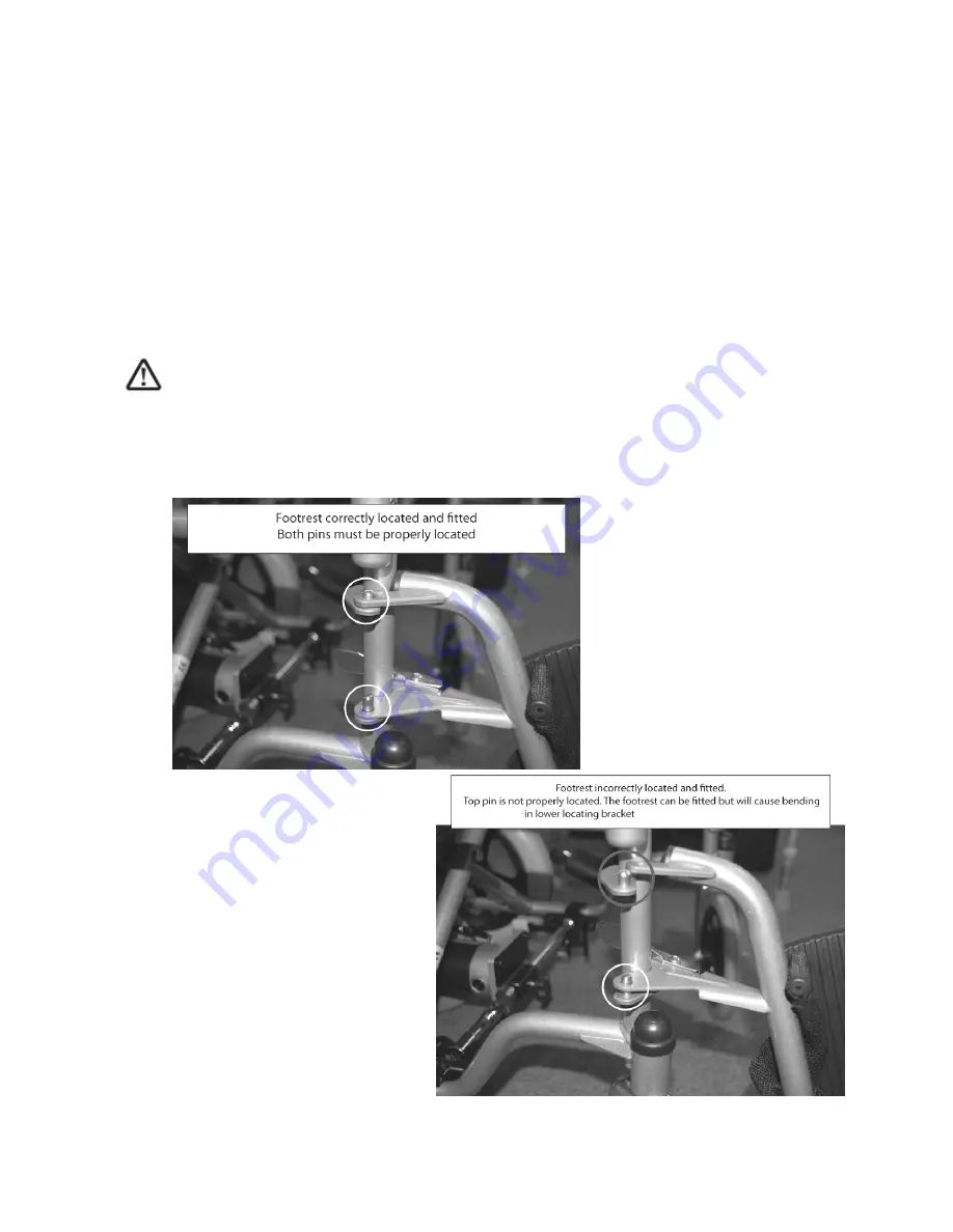 Roma Medical 1415 Self Propel Wheelchair User Manual Download Page 11