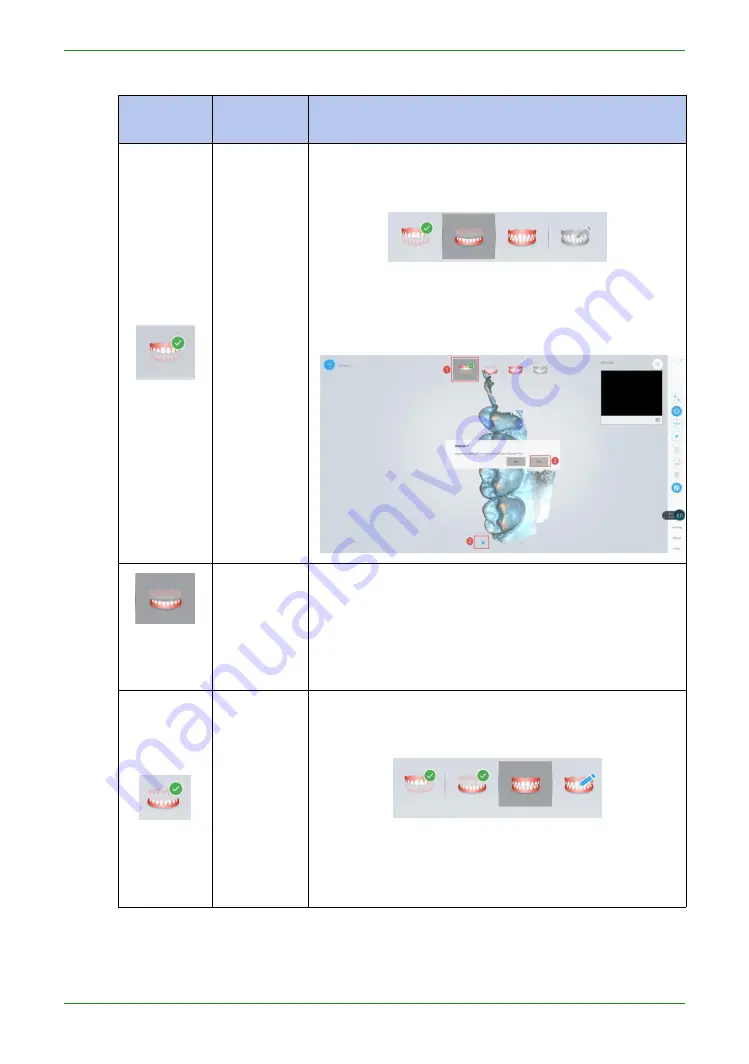 Shining 3D Intraoral Scanner Manual Download Page 53