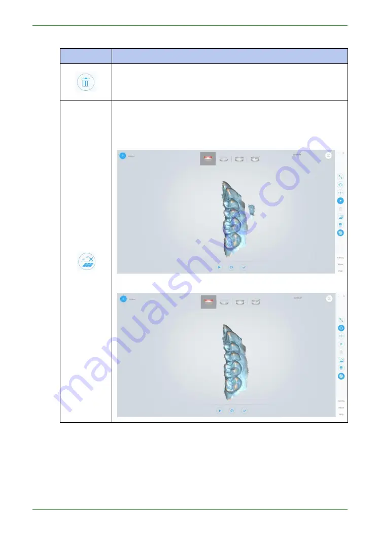 Shining 3D Intraoral Scanner Manual Download Page 60