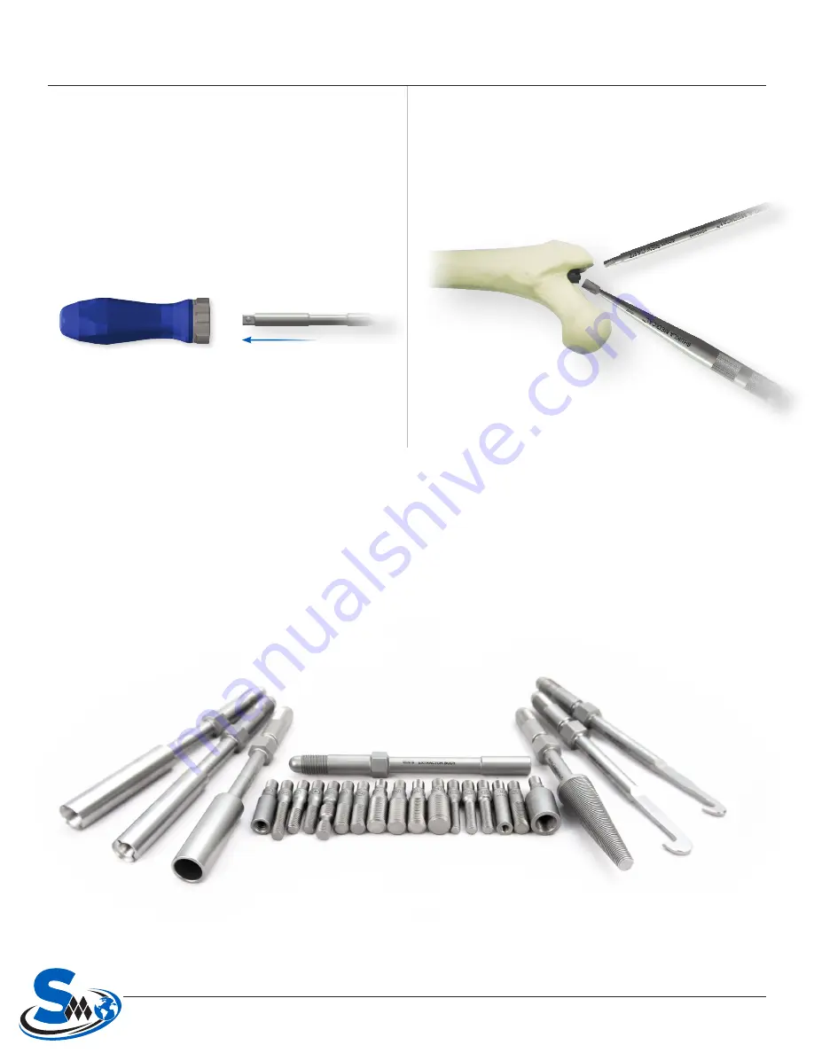 Shukla Medical Xtract-All Nail Winquist III MSK1017 Surgical Technique Manual Download Page 8