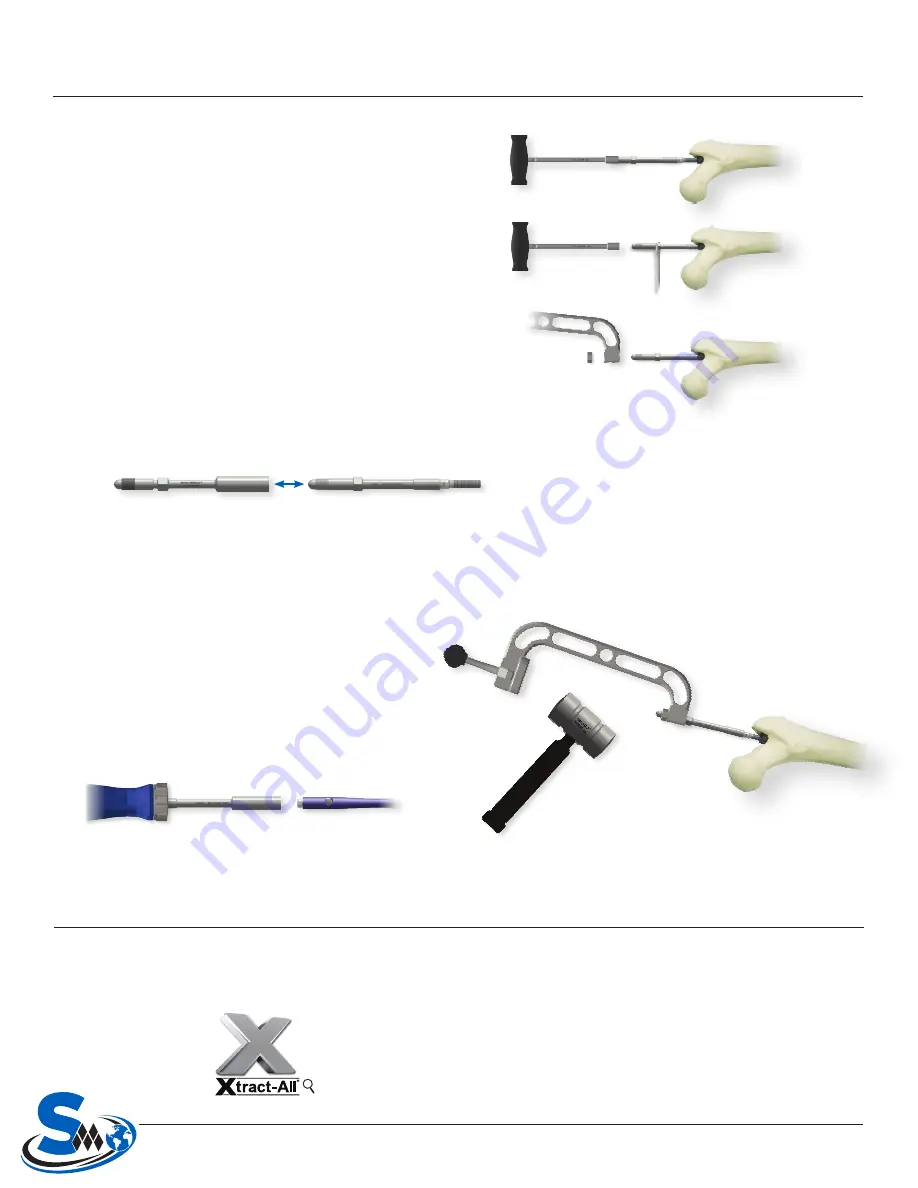 Shukla Medical Xtract-All Nail Winquist III MSK1017 Скачать руководство пользователя страница 10