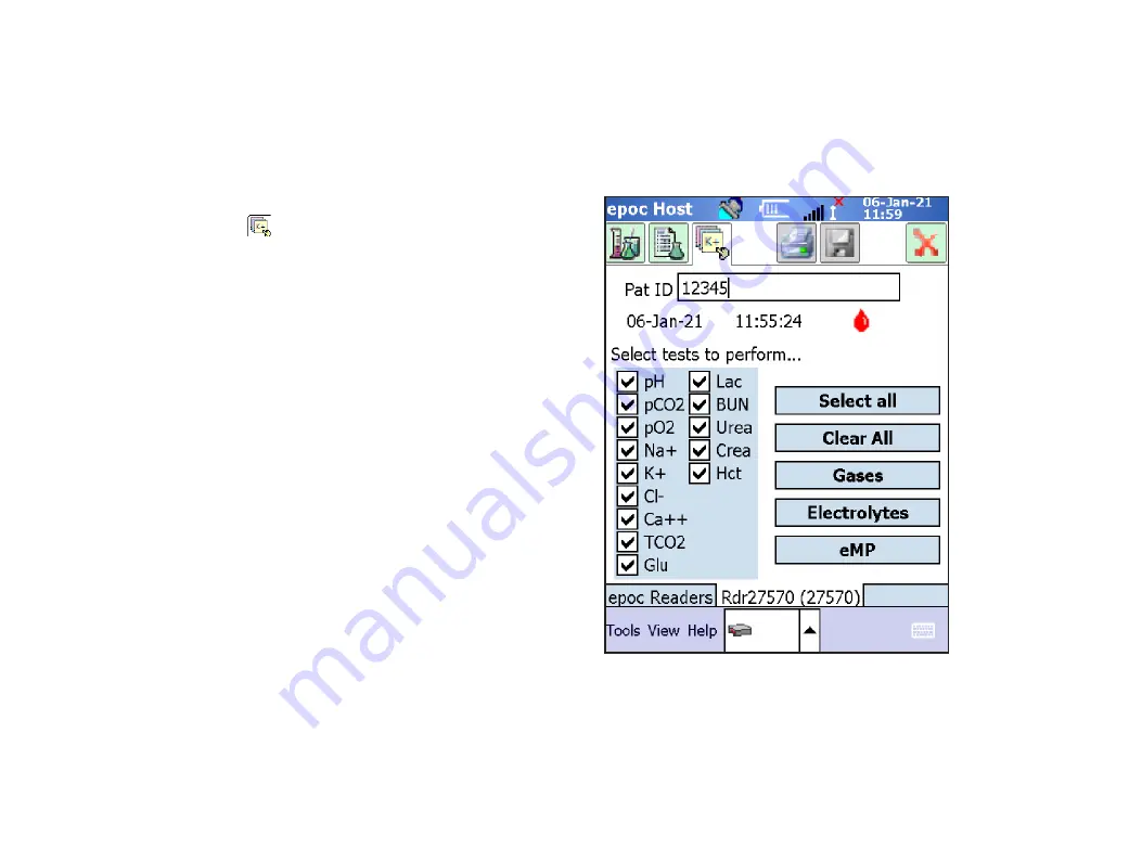 Siemens Healthcare epoc Resource Manual Download Page 14