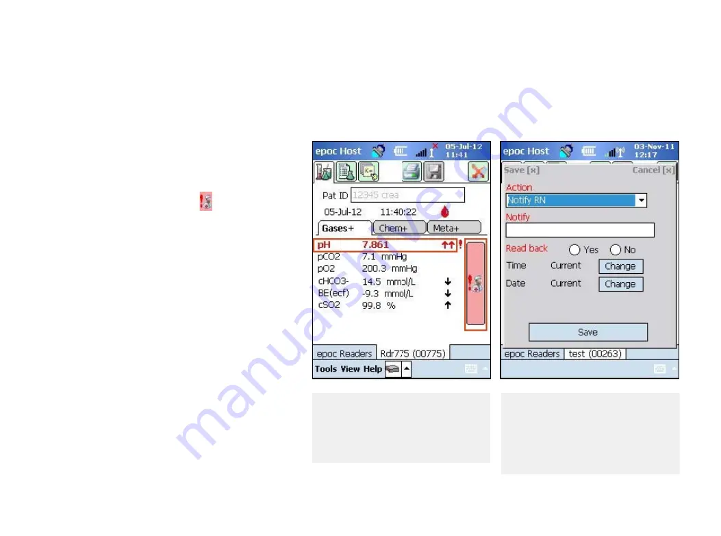 Siemens Healthcare epoc Resource Manual Download Page 18