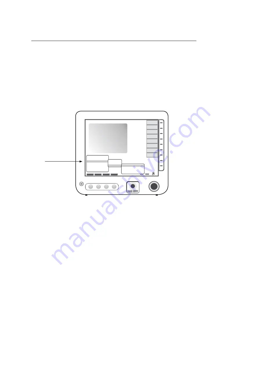 Siemens ACUSON Freestyle User Manual Download Page 72