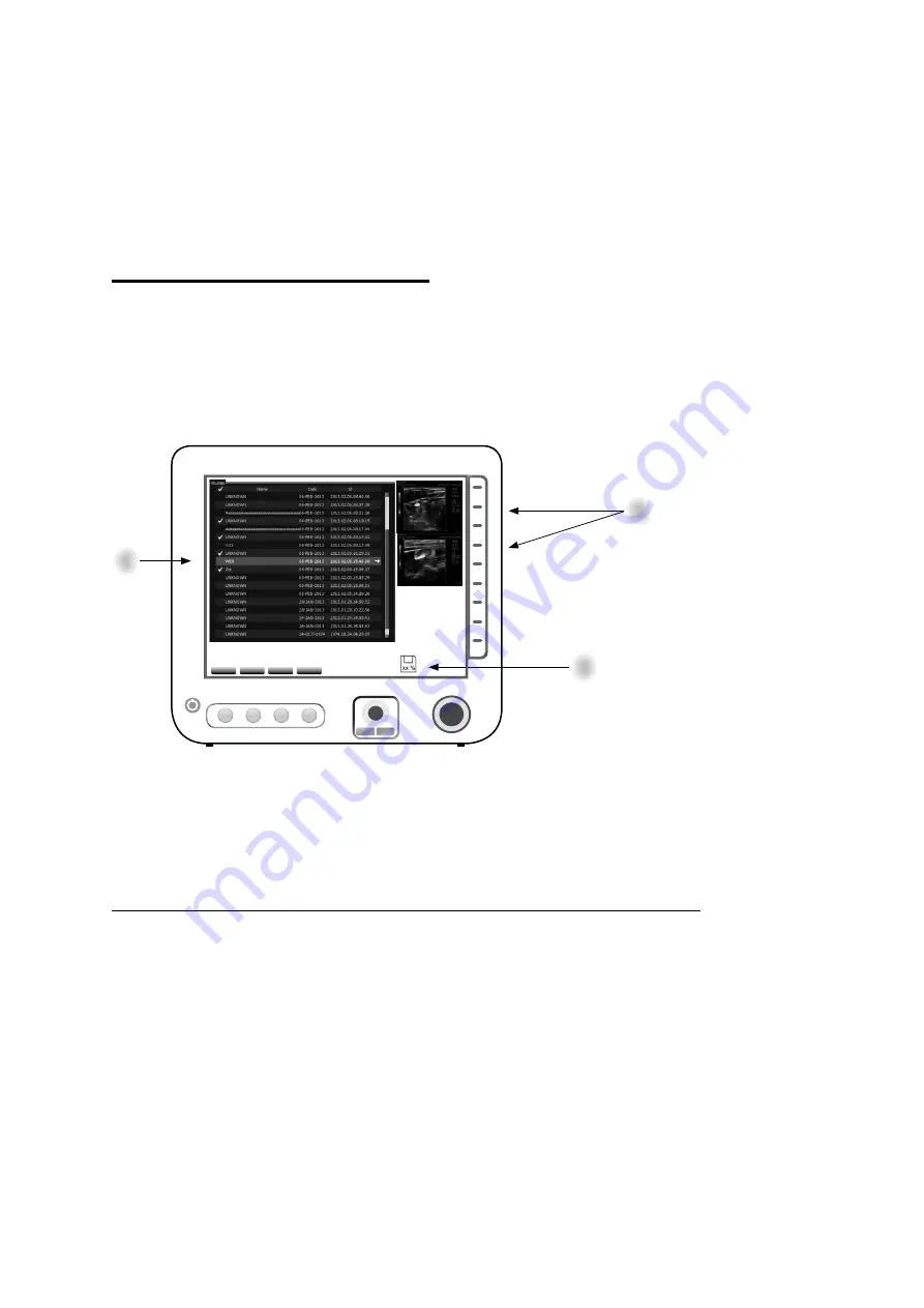 Siemens ACUSON Freestyle User Manual Download Page 87