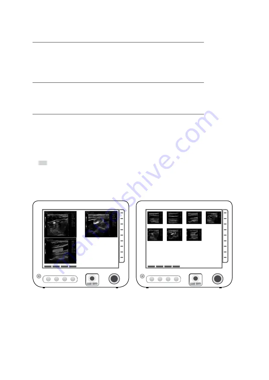 Siemens ACUSON Freestyle User Manual Download Page 88