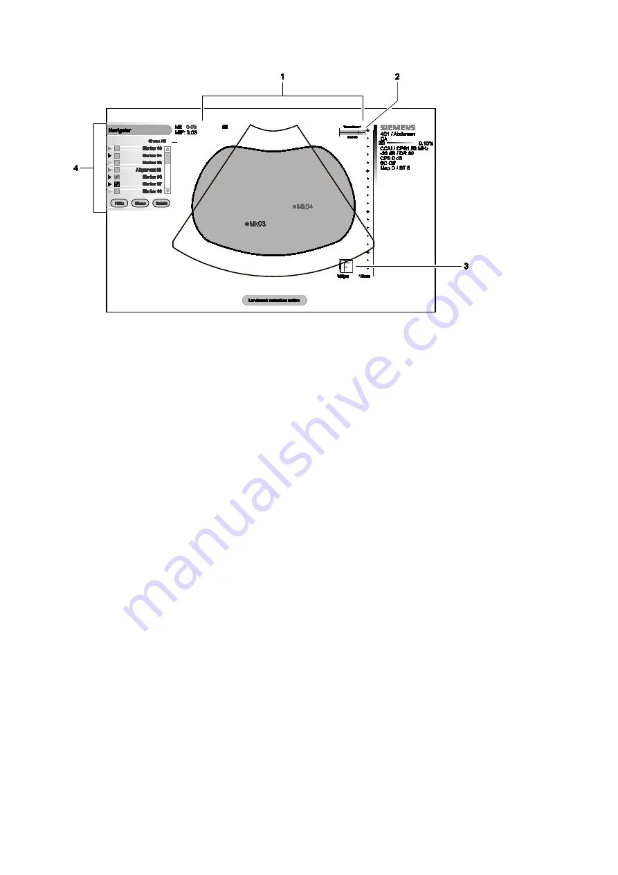 Siemens Acuson S2000 Instructions For Use Manual Download Page 210