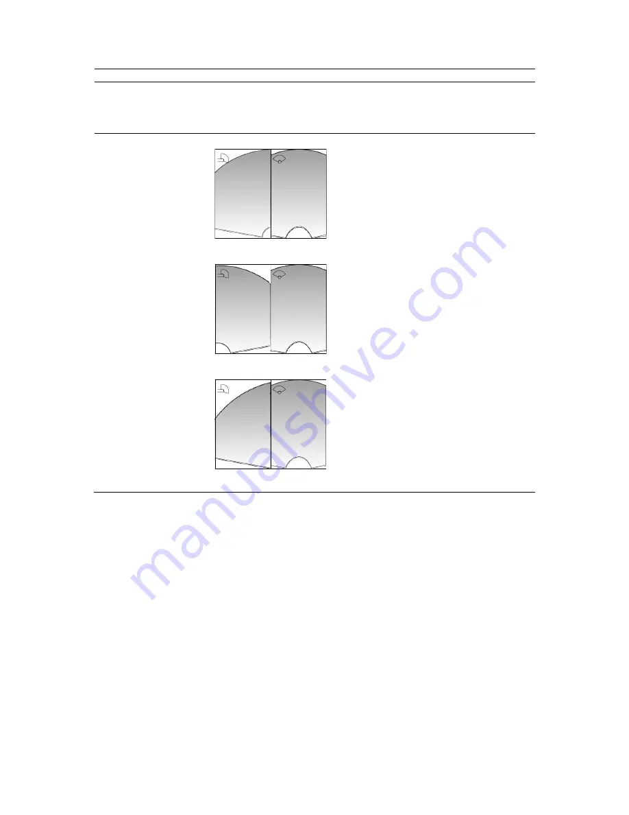 Siemens ACUSON X150 User And Reference Manual Download Page 15