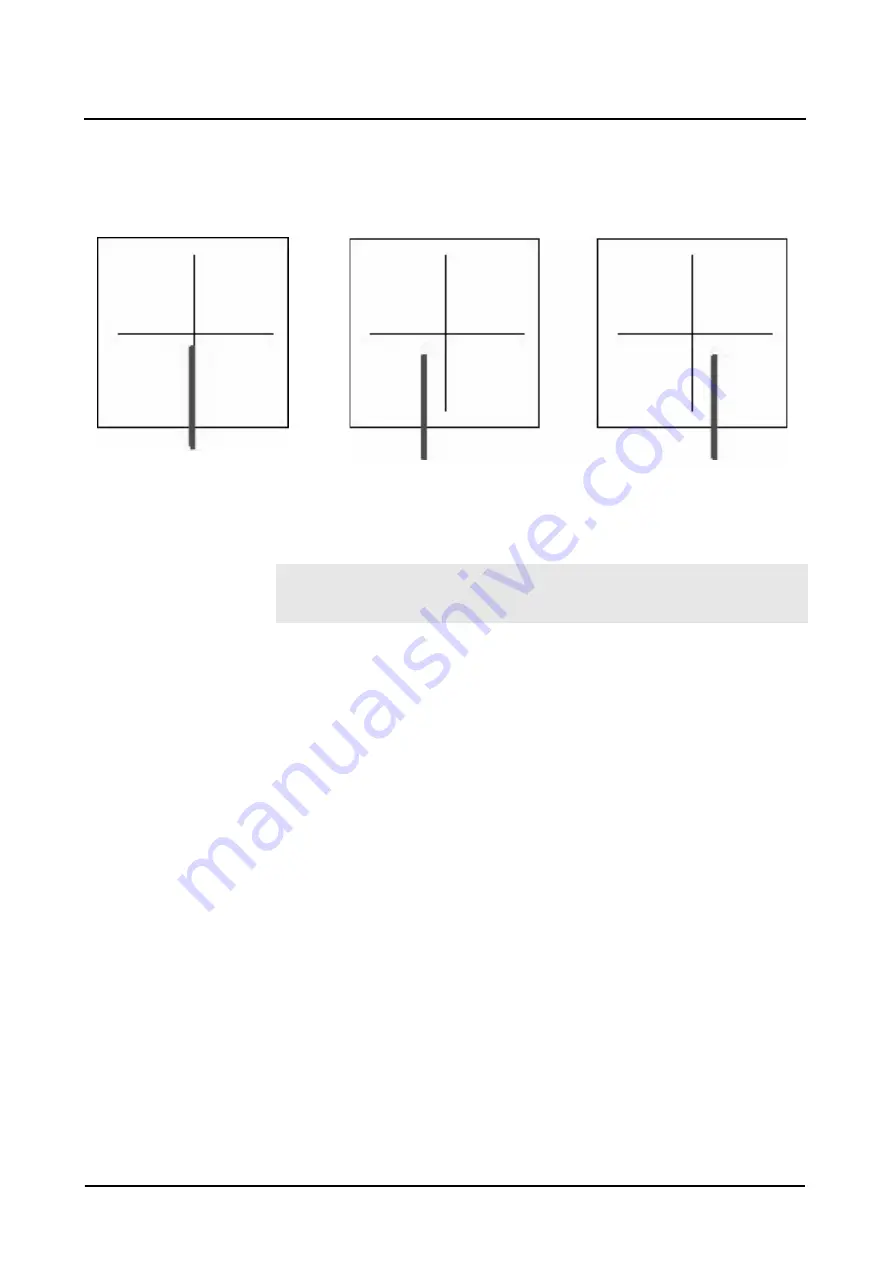 Siemens AXIOM Iconos R200 Operator'S Manual Download Page 51